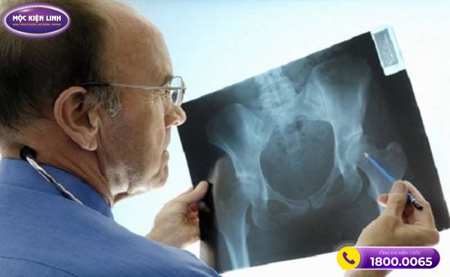 Chụp X-quang giúp chẩn đoán đau xương mu khớp háng