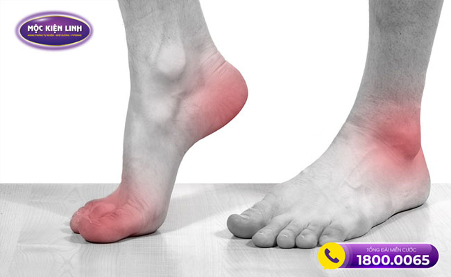 Nguyên nhân dẫn đến đau khớp cổ chân không sưng